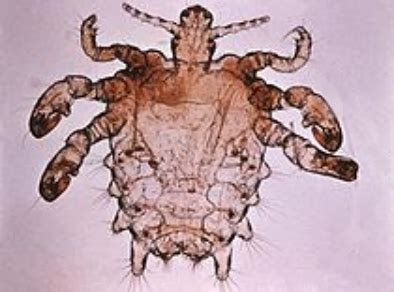 Wszy - ENCYKLOPEDIA PASOŻYTÓW
