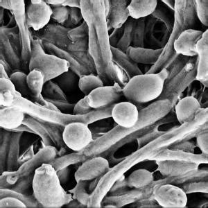 Кандида Candida albicans, полимеразная цепная реакция (ПЦР): норма и ...
