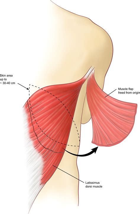How To Strengthen Chest Wall Muscles at Otto Atkinson blog