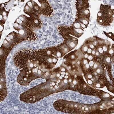 UROD Antibodies: Novus Biologicals