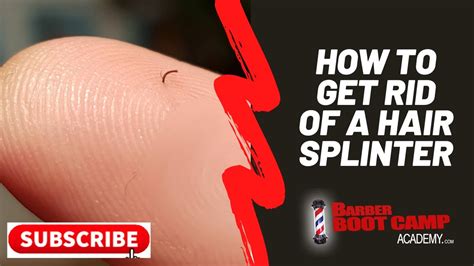 How to Remove a Hair Splinter - YouTube