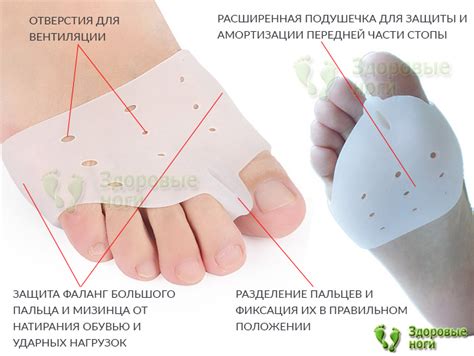 Купить усиленную стяжку переднего отдела стопы с межпальцевой ...