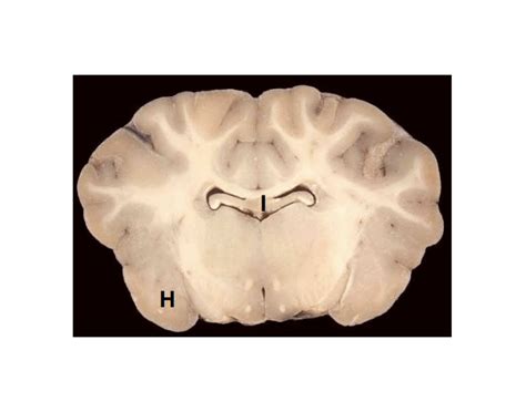 coronal section  quiz