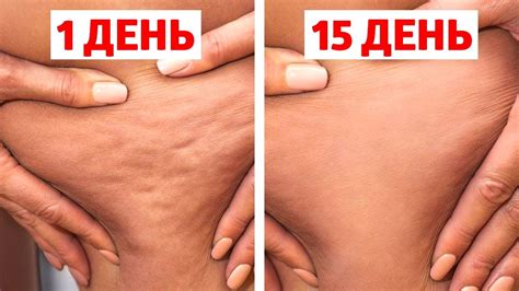 ЦЕЛЛЮЛИТ УЙДЕТ НАВСЕГДА, ЕСЛИ ДЕЛАТЬ ЭТО КАЖДЫЙ ДЕНЬ! - YouTube