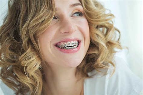 The Best and Worst Times to Get Braces for Teenagers Revealed 1