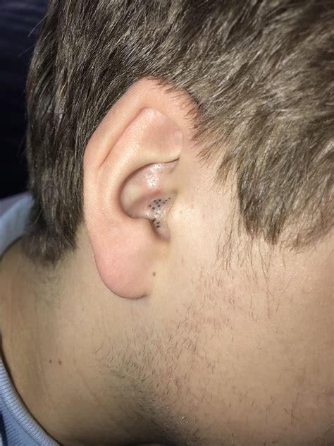 Blackhead goldmine in my friends ear : r/popping