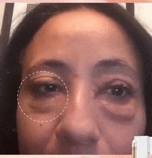 Instant Eye Bag Removal | Shopenzer, Inc.