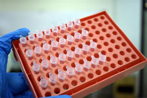 VA Pays $3 Million to Coast Guard Veteran After Missed Lab Result Leads