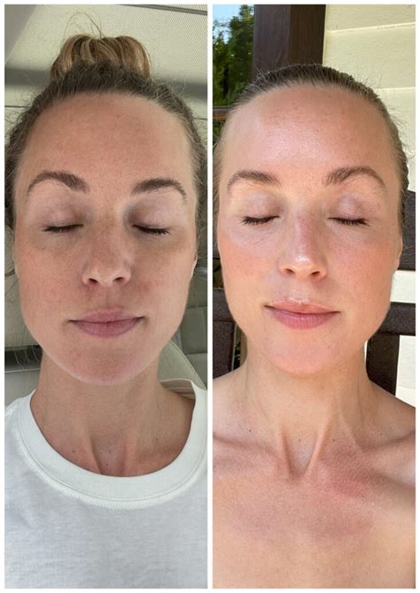 levisa lazer: Before & After Photos That Will Amaze You - rsfgx92