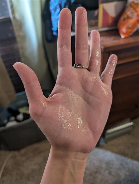 Anybody wanna do a sweaty high five with me? : r/Hyperhidrosis