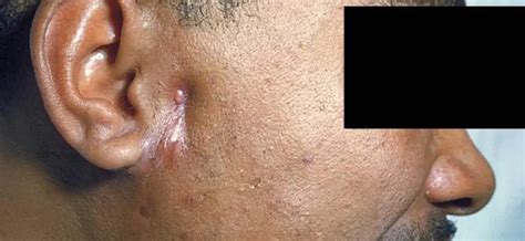 facial swelling  adults healthy food