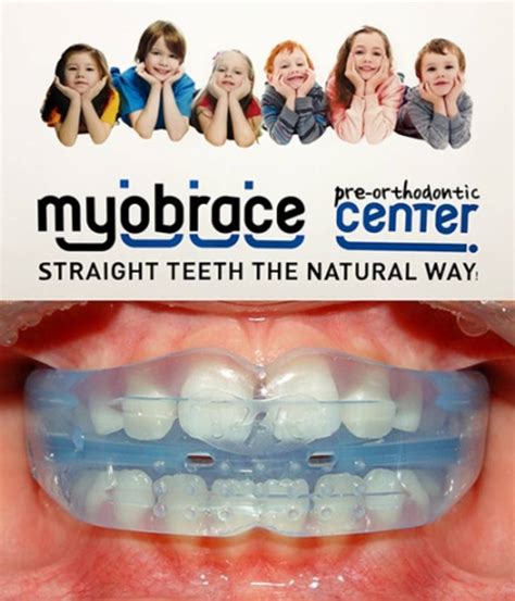Myobrace | Lingewaard Tandartsen