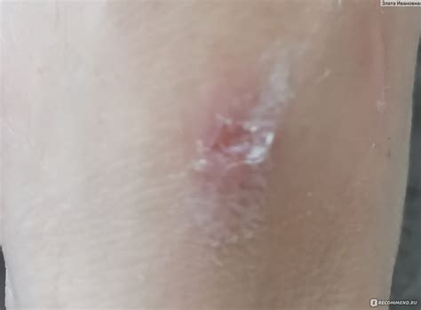 Крем A-derma Dermalibour+ Repairing Cream Дермалибур+ - «SOS крем ...