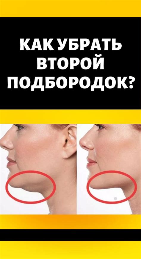 Как убрать второй подбородок? | Гладкое лицо, Лицо, Подтяжка кожи
