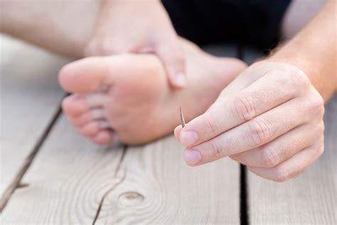 7 Effective Tips On How To Get a Splinter Out - Fast Pace Health