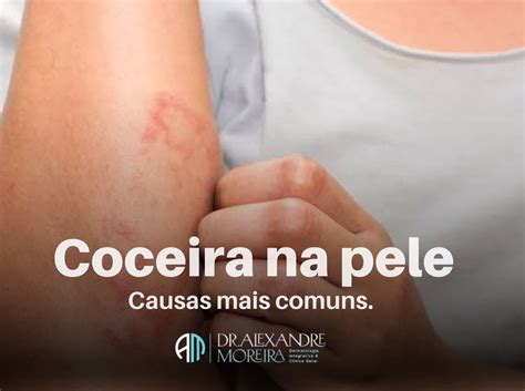 Verme Que Da Coceira - 6