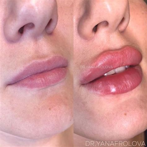 two women's lips are shown with their noses slightly closed and one is ...