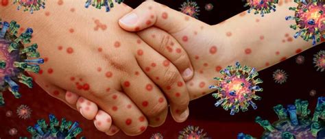 Most Communicable Diseases in India