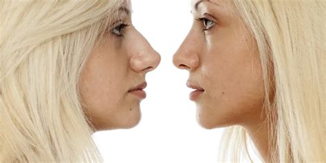 Bulbous Nose Makeup Tips | Saubhaya Makeup