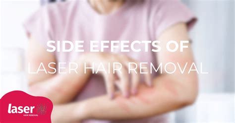 8 Side effects of Laser Hair Removal