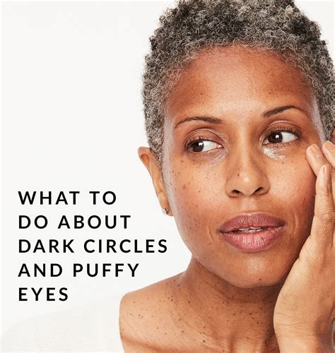 What to Do About Dark Circles and Puffy Eyes