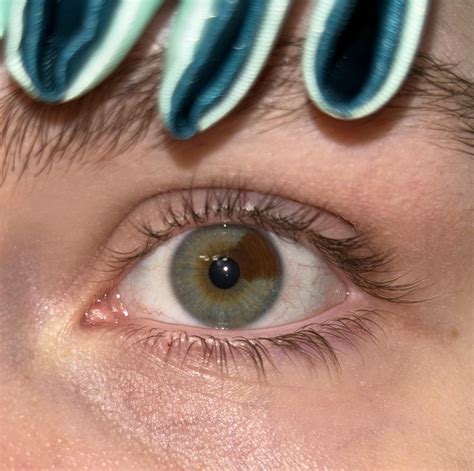Do I have 2 types of heterochromia? : r/heterochromia