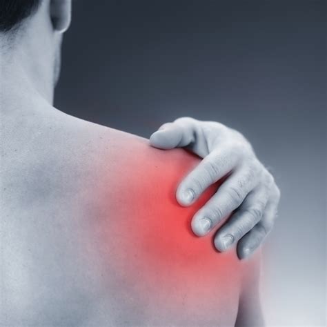 bursitis