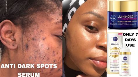 Serum For Dark Spots On Face at Sophie Catani blog