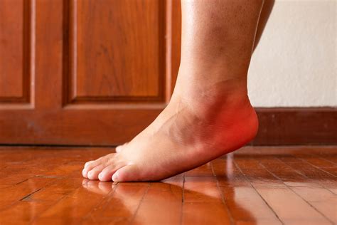 plantar fasciitis treatment at home 6