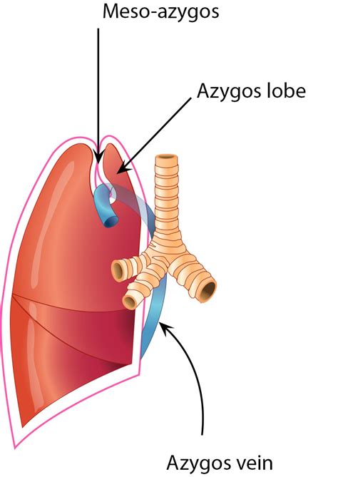 recurrent hemoptysis  complication    azygos lobe