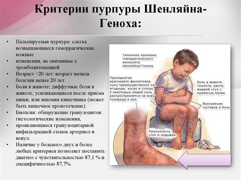 Системные васкулиты - online presentation