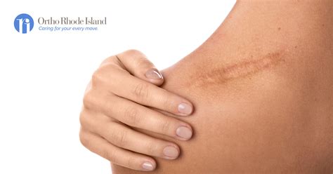 Stab Wounds Scars