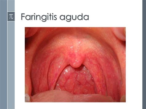 Anatomia de la faringe