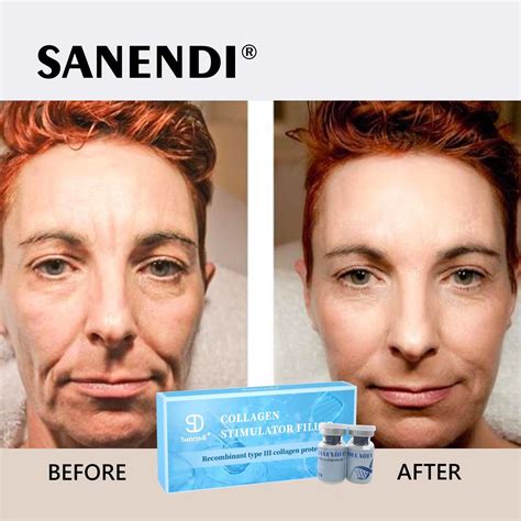 Buy Wholesale China Best Sellers Beauty Face Collagen Injectable Body