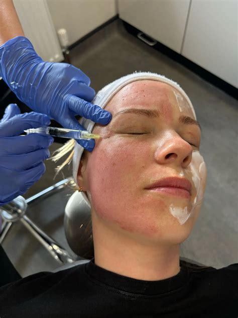 Experts have finally explained the long term benefits of acesshra 13