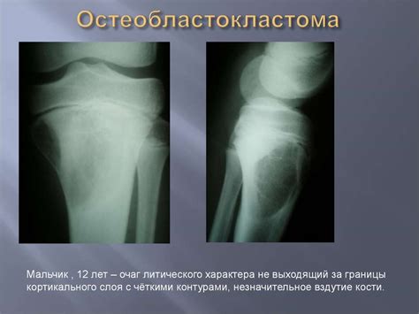 Дифференциальная диагностика опухолей и опухолеподобных процессов ...