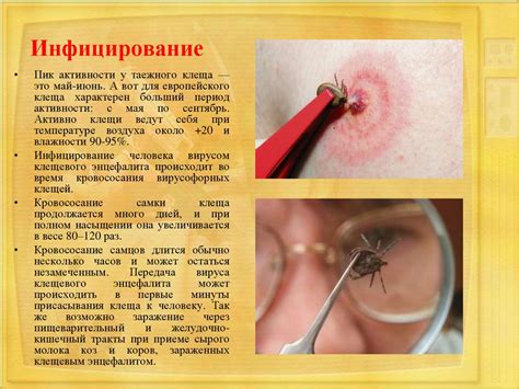 Клещевой энцефалит - презентация онлайн