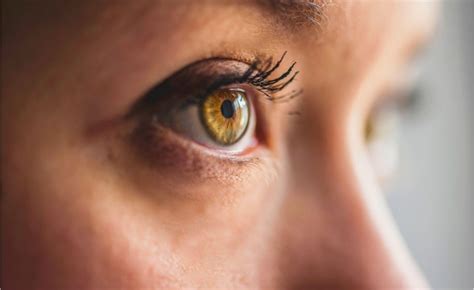 Heavy Eyebrow Droop after Botox | Dr Majid Shah