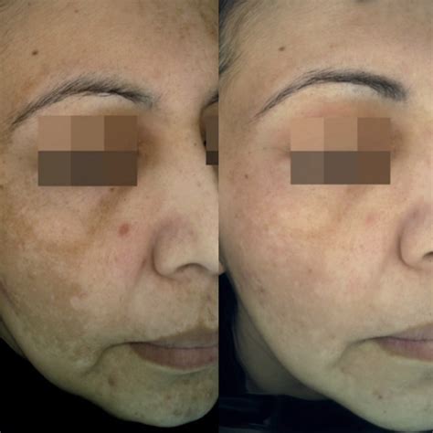 Image Gallery - Derma Revive Skin Clinic