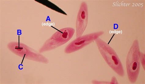 Kingdom Protoctista