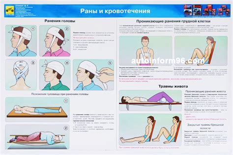 Купить плакат доврачебная помощь при дорожно-транспортном происшествии