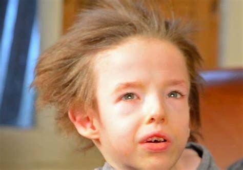 New Video: Menkes Disease : Finding Help & Hope - Global Genes