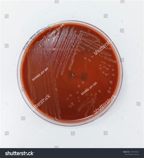 neisseria gonorrhoeae gram negative diplococci kidney