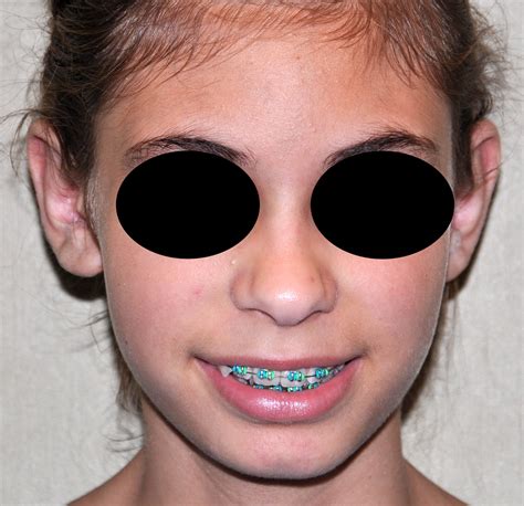 The Janicee Nicole Leak: A Case Study In Long-Term Consequences Image 4