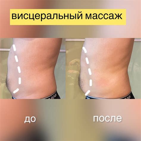 Benefits of visceral massage!?️ Visceral massage of the body makes it ...