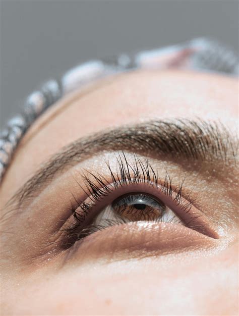 Eyebag treatment non surgically | Safe. Effective. Short downtime ...