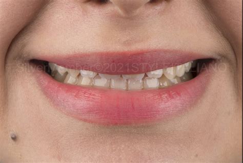 Achieving healthy and harmonious smile by following modern and ...