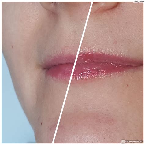 Бальзам для губ Divage "Lip rehab balm" sos восстановление с экстрактом ...
