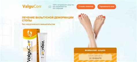 ВАЛЬГУКОР (ValguCorr) мазь от вальгуса - Развод? Проверка