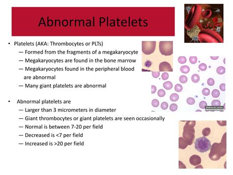 PPT - Abnormal Blood Cell Morphology PowerPoint Presentation, free ...